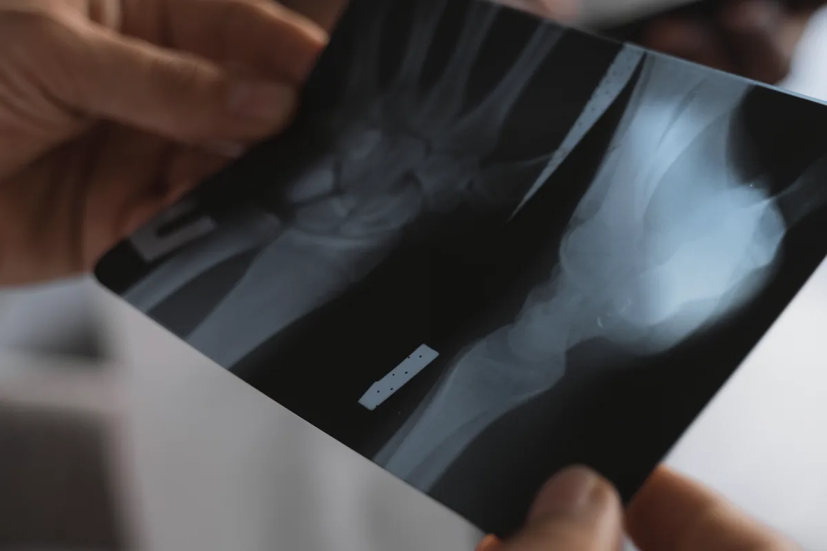 Medical professional reviewing an X-ray image
